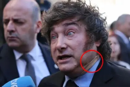 ¿qué le pasó a Milei en el cuello? la explicación del gobierno sobre el vendaje que mostró en españa - Diario Criterio Online
